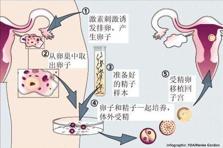 助孕包生男孩服务