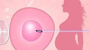 体外受精 IVF-ET